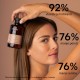APIVITA ŠAMPON PROTIV SUVE PERUTI 250ML