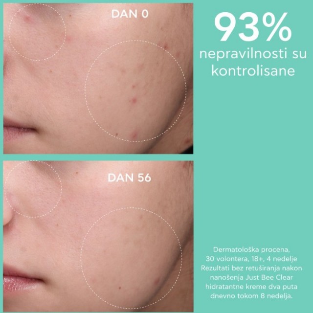 APIVITA JUST BEECLEAR KREMA 40ML