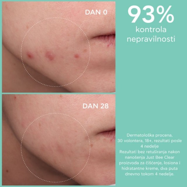 APIVITA JUST BEECLEAR LOSION 200ML APIVITA JUST BEECLEAR LOSION 200ML