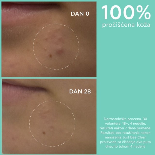 APIVITA JUST BEECLEAR GEL ZA ČIŠĆENJE 200ML APIVITA JUST BEECLEAR GEL ZA ČIŠĆENJE 200ML