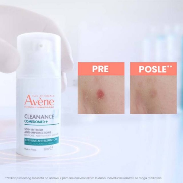 AVENE CLEANANCE COMEDOMED+ 30ML AVENE CLEANANCE COMEDOMED+ 30ML