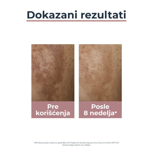 EUCERIN ANTI-PIGMENT NOĆNA KREMA 50ML