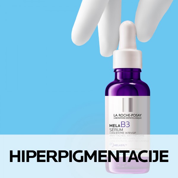 HIPERPIGMENTACIJE