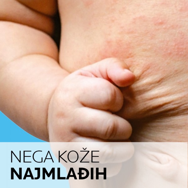 NEGA KOŽE NAJMLAĐIH
