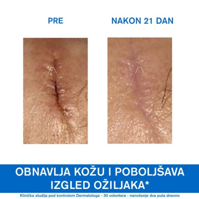 URIAGE BARIEDERM CICA KREM 100ML