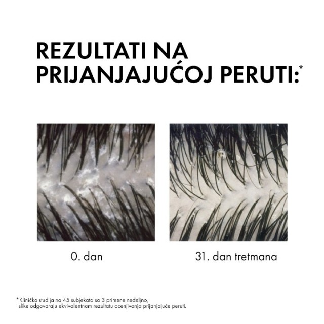 VICHY DERCOS ANTI-DANDRUFF ŠAMPON PROTIV PERUTI ZA SUVU KOSU 200ML