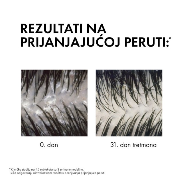 VICHY DERCOS ANTI-DANDRUFF ŠAMPON PROTIV PERUTI ZA NORMALNU DO MASNU KOSU 500 ML  REFILL