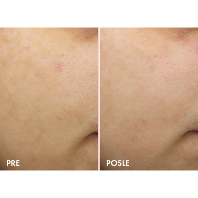 VICHY LIFTACTIV SPECIALIST B3 DARK SPOTS NOĆNA KREMA PROTIV TAMNIH HIPERPIGMENTACIJSKIH FLEKA I BORA 50ML