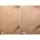 VICHY LIFTACTIV SPECIALIST B3 DARK SPOTS NOĆNA KREMA PROTIV TAMNIH HIPERPIGMENTACIJSKIH FLEKA I BORA 50ML