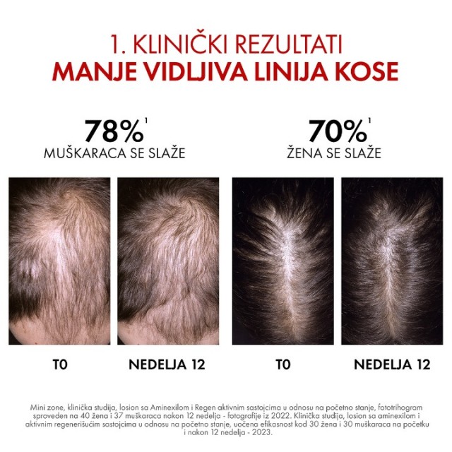 VICHY DERCOS AMINEXIL REGEN BOOSTER CLINICAL SERUM ZA KOSU 90ML VICHY DERCOS AMINEXIL REGEN BOOSTER CLINICAL SERUM ZA KOSU 90ML