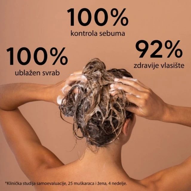 APIVITA ŠAMPON PROTIV MASNE PERUTI 250ML