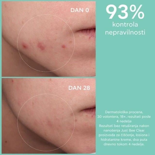 APIVITA JUST BEECLEAR LOSION 200ML