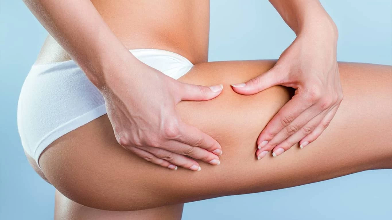 Kako skinuti celulit na prirodan način? 8 saveta od dermatologa!