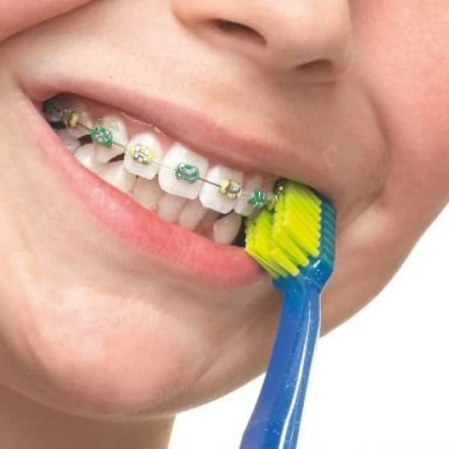 CURAPROX ČETKICA ORTHO CS 5460 A1