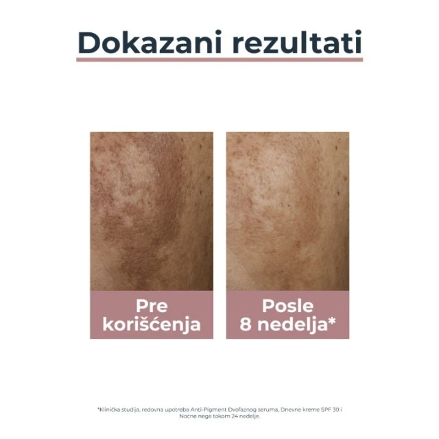 EUCERIN ANTI-PIGMENT SPF30 DNEVNA KREMA 50ML