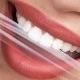 HELLO SMILE PAP+ TRAKICE ZA IZBELJIVANJE ZUBA 14 x 2 para