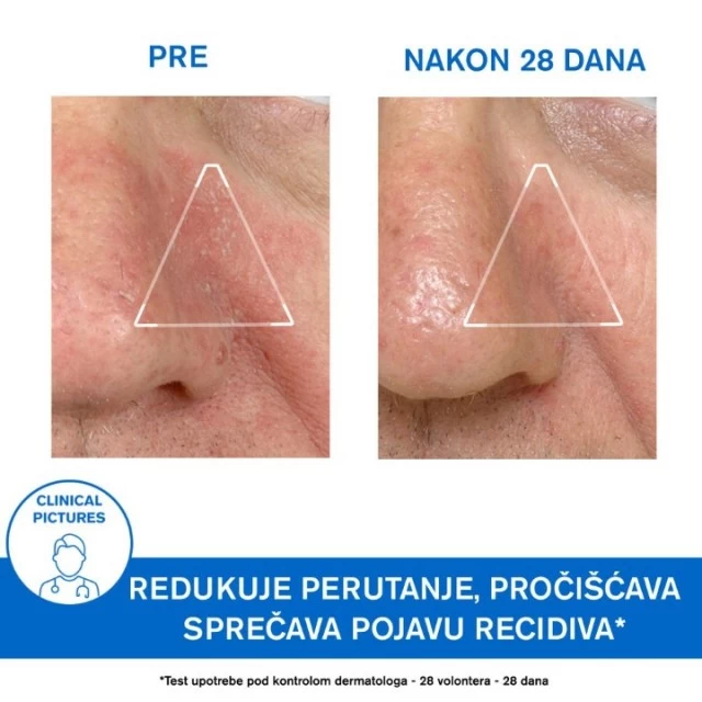 URIAGE D.S. EMULZIJA 40ML