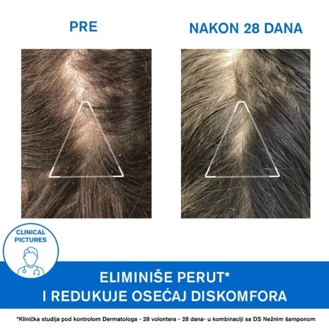 URIAGE DS ŠAMPON PROTIV PERUTI 200ML