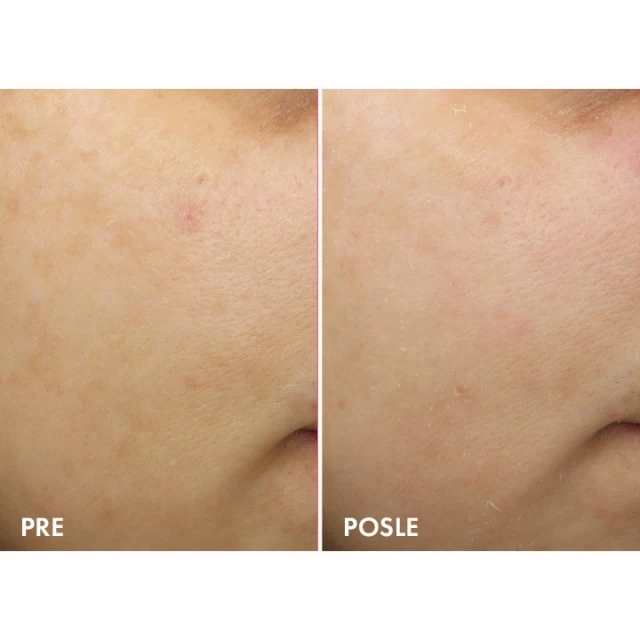 VICHY LIFTACTIV SPECIALIST B3 DARK SPOTS NOĆNA KREMA PROTIV TAMNIH HIPERPIGMENTACIJSKIH FLEKA I BORA 50ML