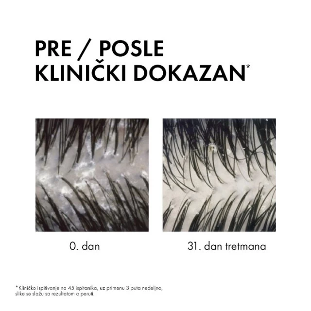VICHY DERCOS ŠAMPON PROTIV PERUTI DS 2U1 200ML