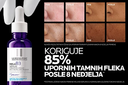 La Roche-Posay MELA B3 SERUM dokazano na svim fototipovima kože, tamnim flekama, flekama nakon akni i neujednačenost